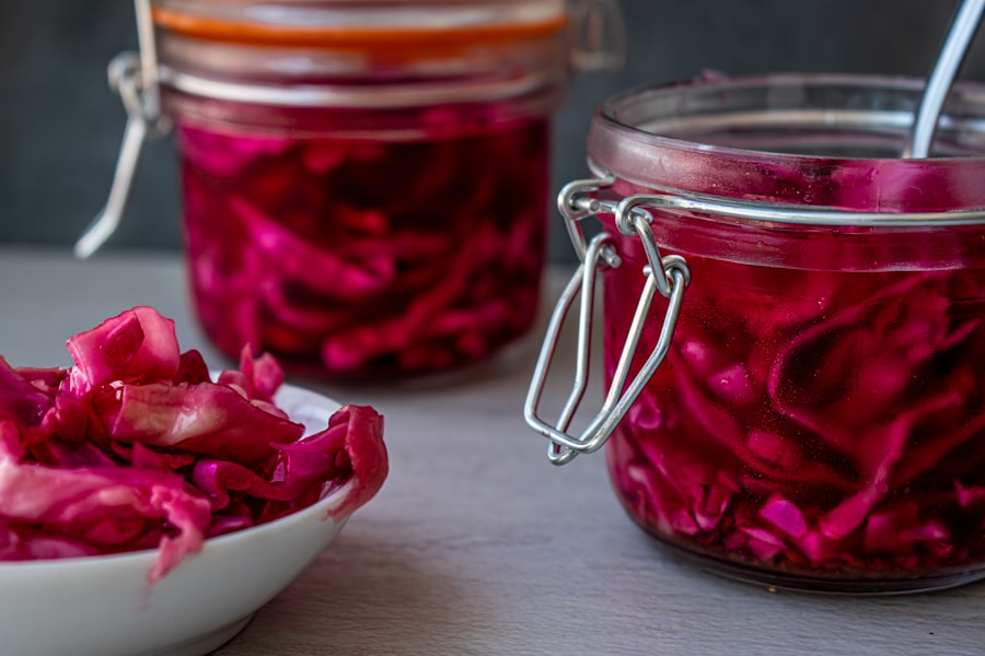 Кишечник, ЖКТ, желудок